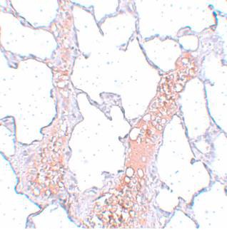ab106462, at 5 ug/ml, staining C5orf19 in paraffin-embedded rat lung tissue.