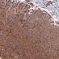 ab122828 at 1/200 dilution staining C5orf22 in Paraffin-embedded Human urinary bladder tissue by Immunohistochemistry.