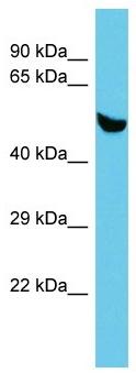 Anti-C5orf22 antibody (ab157606) at 1 µg/ml + Human fetal brain lysate at 10 µg