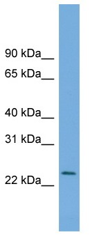 Anti-C5orf24 antibody (ab104371) at 1 µg/ml + ACHN cell lysate at 10 µg