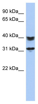 Anti-C5orf35 antibody (ab87548) at 1 µg/ml + Jurkat cell lysate at 10 µgSecondaryHRP conjugated anti-Rabbit IgG at 1/50000 dilution