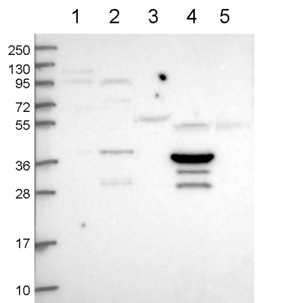 All lanes : Anti-C5orf45 antibody (ab150917) at 1/100 dilutionLane 1 : RT 4 cell lysateLane 2 : U 251 MG cell lysateLane 3 : Human plasma lysateLane 4 : Human liver lysate Lane 5 : Human tonsil lysate