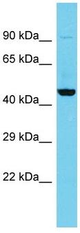 Anti-C5orf45 antibody - N-terminal (ab157629) at 1 µg/ml + Human fetal kidney lysate at 10 µg