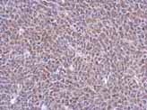 ab127919, at 1/500, staining C5orf54 in Human BT483 xenograft by immunohistochemistry [Paraffin Embedded Tissues (IHC-P).