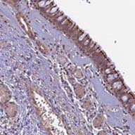 ab126337, at a dilution of 1/50, staining C6orf129 in paraffin-embedded Human nasopharynx tissue by Immunohistochemistry.