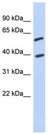 Anti-C6orf146 antibody (ab89026) at 1 µg/ml + Jurkat cell lysate at 10 µgSecondaryHRP conjugated anti-Rabbit IgG at 1/50000 dilution