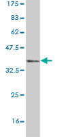Western blot against tagged recombinant protein immunogen using ab58015 ACMSD antibody at 1ug/ml.