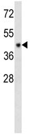 Anti-C6orf150 antibody (ab106985) at 1/100 dilution + MDA-MB231 cell line lysates at 35 µg