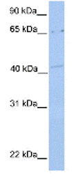 Anti-C6orf192 antibody (ab81377) at 1 µg/ml + 721 B cell lysate at 10 µgSecondaryHRP conjugated anti-Rabbit IgG at 1/50000 dilution