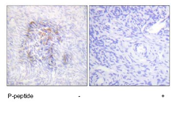 Immunohistochemical analysis of Aconitase 1 (phospho S138) expression in paraffin-embedded human ovary tissue using ab63260 at 1/50. Left image: untreated. Right image: sample treated with immunising phosphopeptide.