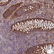 Immunohistochemical analysis of paraffin-embedded Human rectum tissue labeling C6orf203 with ab151066 at 1/200 dilution.