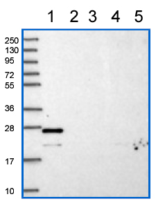 All lanes : Anti-C6orf203 antibody (ab151066) at 1/250 dilutionLane 1 : RT-4 lysateLane 2 : U-251 MG lysateLane 3 : Human plasma lysateLane 4 : Human liver lysateLane 5 : Human tonsil lysate