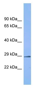 Anti-C6orf203 antibody - C-terminal (ab157650) at 1 µg/ml + Human fetal kidney tissue lysate at 10 µg