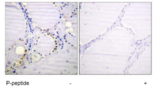 ab62451, at 1/50 dilution, staining Aconitase 1 in paraffin embedded human thyroid gland tissue by Immunohistochemistry in the absence or presence of the immunising peptide.