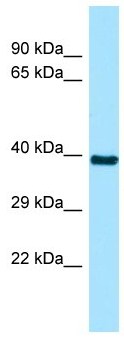 Anti-C6orf206 antibody - N-terminal (ab136694) at 1 µg/ml + 721_B cell lysate at 10 µg