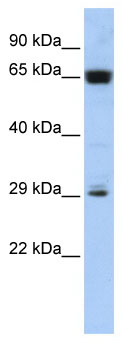 Anti-c6orf223 antibody (ab86232) at 1 µg/ml + Jurkat cell lysate at 10 µgSecondaryHRP conjugated anti-Rabbit IgG at 1/50000 dilution