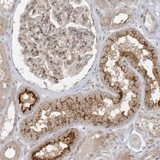 ab122306, at 1/10, staining C6orf225 in paraffin embedded Human kidney tissue by Immunohistochemistry.