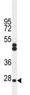 Anti-C6orf62 antibody (ab107371) at 1/100 dilution + CHO cell line lysate at 35 µg
