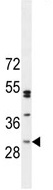 Anti-C6orf62 antibody (ab107371) at 1/100 dilution + Mouse kidney tissue lysate at 35 µg