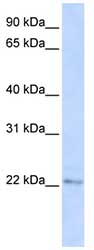 Anti-C6orf64 antibody (ab82803) at 1 µg/ml (in 5% skim milk / PBS buffer) + 293T cell lysate at 10 µgSecondaryHRP conjugated anti-Rabbit IgG at 1/50000 dilution