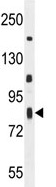 Anti-C6orf70 antibody (ab107444) at 1/100 dilution + A2058 cell line lysate at 35 µg
