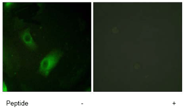 ab61197 at 1/500 dilution staining Aconitase 1 in HeLa cells by Immunofluorescence, in the absence (left) or presence (right) of the immunising peptide.