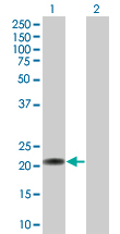 All lanes : Anti-C7orf16 antibody (ab67159) at 1/500 dilutionLane 1 : transfected 293T cell lysate Lane 2 : non transfected 293T cell lysateLysates/proteins at 25 µg per lane.SecondaryGoat Anti-Mouse IgG (H&L)-HRP Conjugate secondary antibody at 1/2500 dilution
