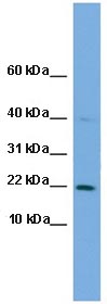 Anti-C7orf16 antibody (ab106598) at 1 µg/ml + THP-1 cell lysate at 10 µg