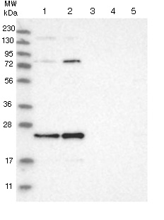 All lanes : Anti-C7orf30 antibody (ab121631) at 1/250 dilutionLane 1 : RT4 cell lysateLane 2 : U-251 MG cell lysateLane 3 : Human Plasma lysateLane 4 : Human Liver lysateLane 5 : Human Tonsil lysate