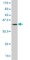 Western blot against tagged recombinant protein immunogen using ab54718 Aconitase 1 antibody at 1ug/ml.