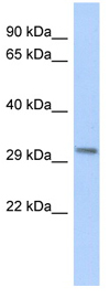 Anti-c8orf84 antibody (ab87593) at 1 µg/ml + human fetal heart lysate at 10 µgSecondaryHRP conjugated anti-Rabbit IgG at 1/50000 dilution
