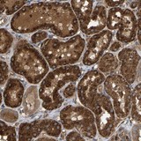 ab121673 at 1/10 dilution staining C9orf116 in Paraffin-embedded Human kidney tissue by Immunohistochemistry.