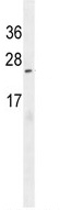 Anti-C9orf150 antibody (ab107372) at 1/100 dilution + MCF7 cell line lysates at 35 µg
