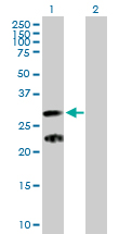 All lanes : Anti-C9orf152 antibody (ab169411) at 1 µg/mlLane 1 : C9orf152 transfected 293T cell lysateLane 2 : Non-transfected 293T cell lysateLysates/proteins at 15 µl per lane.