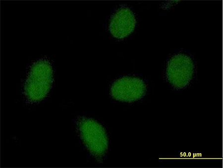 Immunofluorescent analysis of HeLa cells labeling C9orf152 with ab169411 at 10 µg/ml.