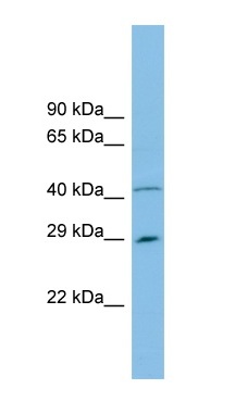 Anti-C9orf152 antibody (ab101976) at 1 µg/ml + THP-1 cell lysate at 10 µgdeveloped using the ECL technique