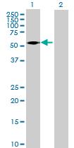 All lanes : Anti-C9orf156 antibody (ab88810) at 1/500 dilutionLane 1 : C9orf156 transfected 293T cell lysateLane 2 : Non-transfected 293T cell lysateLysates/proteins at 25 µg per lane.