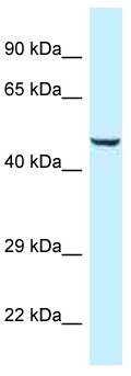 Anti-C9orf156 antibody (ab116334) at 1 µg/ml + Human fetal heart lysate at 10 µg