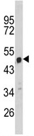 Anti-C9orf156 antibody - C-terminal (ab92623) at 1/100 dilution + HeLa cell line lysate at 35 µg