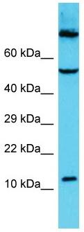 Anti-C9orf16 antibody (ab157661) at 1 µg/ml + HCT15 whole cell lysate at 10 µg