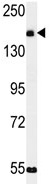 Anti-C9orf174 antibody (ab103744) at 1/100 dilution + Mouse liver tissue lysate at 35 µg