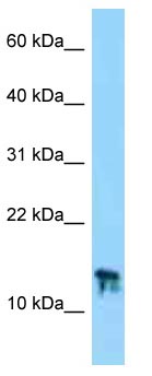 Anti-C9orf25 antibody (ab125364) at 1 µg/ml + Mouse thymus lysate at 10 µg