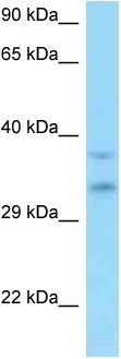 Anti-C9orf30 antibody (ab125413) at 1 µg/ml + HT1080 cell lysate at 10 µg