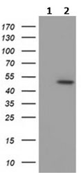 All lanes : Anti-C9orf41 antibody [6A2] (ab117922) at 1/500 dilutionLane 1 : HEK293T cells transfected with pCMV6-ENTRY control Lane 2 : HEK293T cells transfected with pCMV6-ENTRY C9orf41 cDNA Lysates/proteins at 5 µg per lane.