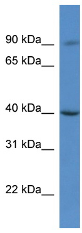 Anti-C9orf64 antibody (ab112088) at 1 µg/ml + HeLa cell lysate at 10 µg