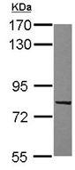 Anti-C9orf86 antibody (ab111866) at 1/5000 dilution + A431 whole cell lysate at 30 µg