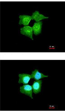 ab111866 at 1/200 dilution staining C9orf86 in paraformaldehyde-fixed A431 cells by Immunofluorescence. The lower panel is costained with Hoechst 33342.