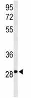 Anti-C9orf95 antibody (ab102988) at 1/100 dilution + WiDr cell lysate at 35 µg