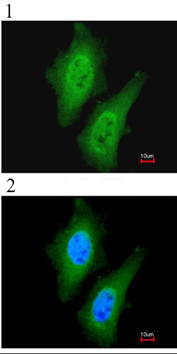 Immunofluorescence analysis of paraformaldehyde-fixed A549, using ab96082 at 1:200 dilution. (1)Ab96082, (2)Merged with DNA probe