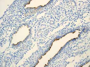 ab110640 showing positive staining in Normal uterus tissue.